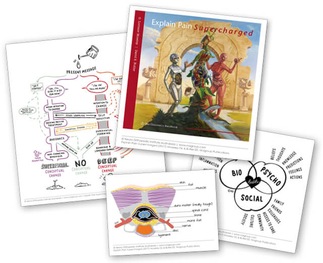 explain pain supercharged pdf explain pain supercharged pdf